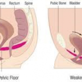 Ασκήσεις  Kegel’s και στην Πρόπτωση; Δυναμώστε τους Μύες του Πυελικού Εδάφους και Μειώστε Αισθητά τα Συμπτώματα!